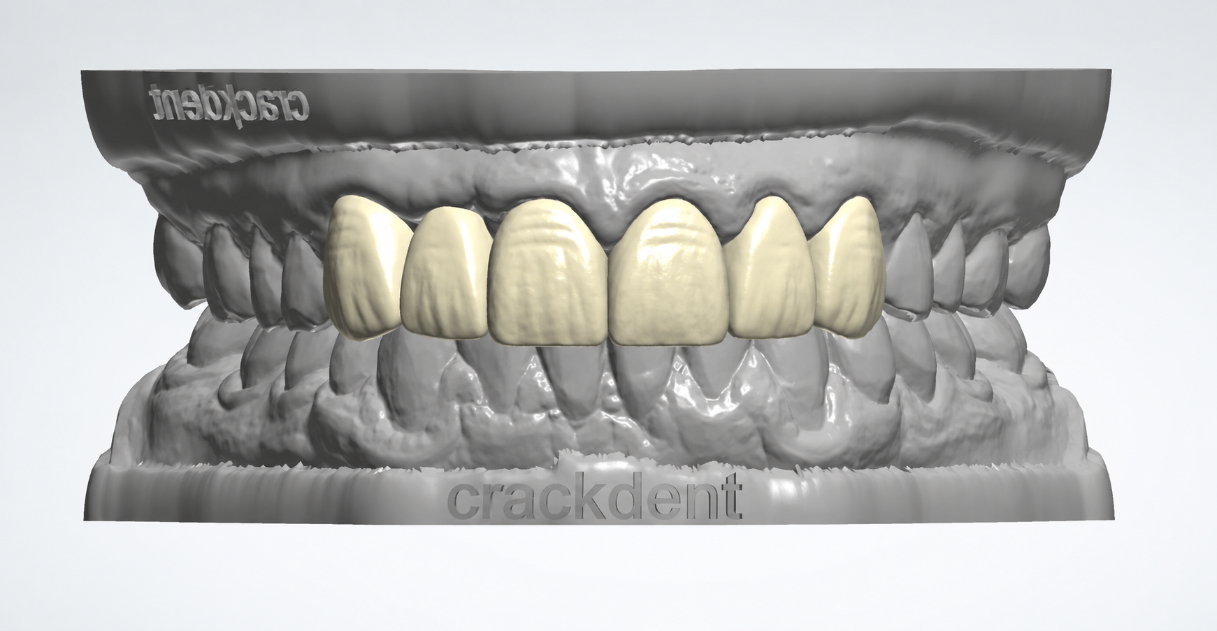 Dental crown and bridge CAD design render